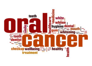 Oral Cancer Screening Pic