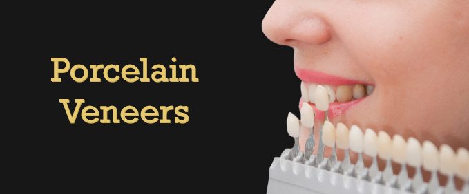 porcelain-veneers