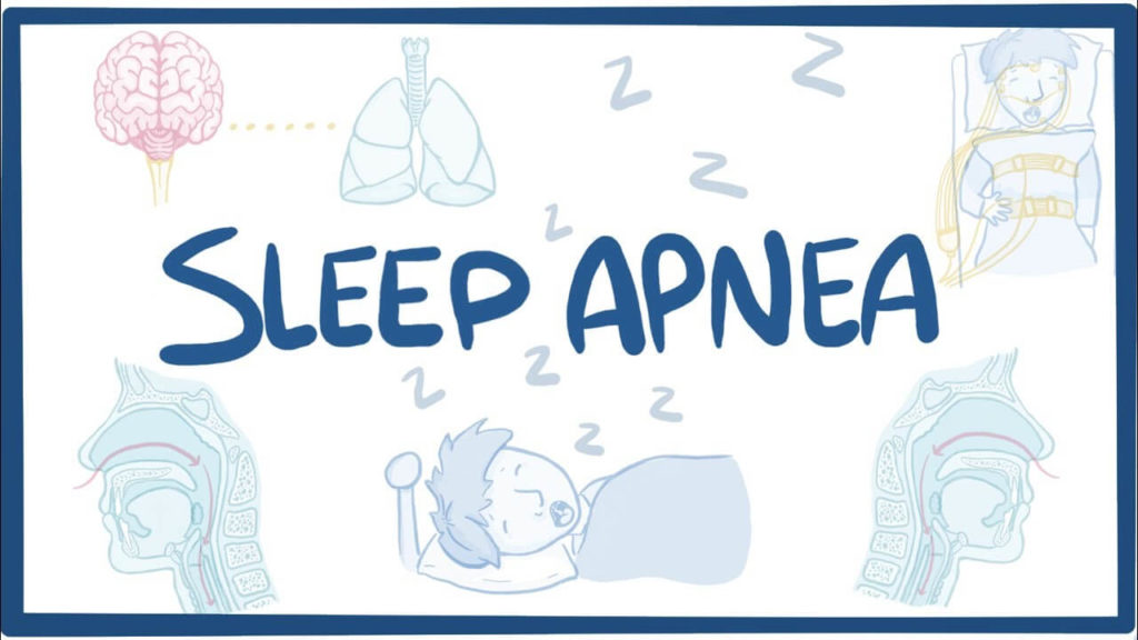 sleep-apnea-causes