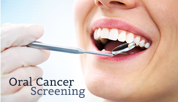 oral-cancer-screening