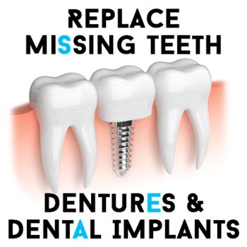 Missing Tooth Replacement 