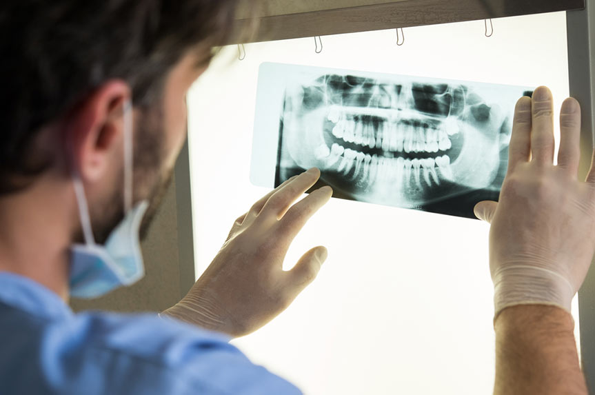 Detecting Tooth Decay Early: The Significance of Early Oral Examinations